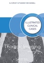 Cover: Thoracic Imaging - CRC Press