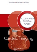 Cover: Cardiac Imaging - CRC Press