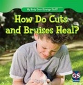 Cover: How Do Cuts and Bruises Heal? - Gareth Stevens Publishing