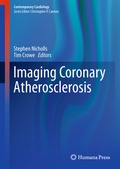 Cover: Imaging Coronary Atherosclerosis - Humana