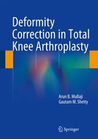 Abbildung von: Deformity Correction in Total Knee Arthroplasty - Springer