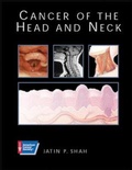Cover: Cancer of the Head and Neck - B.C. Decker Inc