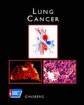 Cover: Lung Cancer - B.C. Decker Inc
