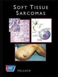Enlarge image Cover: SOFT TISSUE SARCOMAS (AMERICAN CANCER SOCIETY ATLAS OF CLINICAL ONCOLOGY) - B.C. Decker Inc