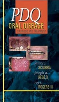 Cover: PDQ Oral Disease: Diagnosis and Treatment - B.C. Decker Inc