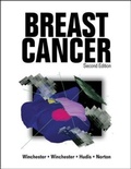 Cover: Breast Cancer - B.C. Decker Inc