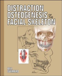 Enlarge image Cover: Distraction Osteogenesis of the Facial Skeleton - B.C. Decker Inc