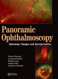 Abbildung von: Panoramic Ophthalmoscopy - SLACK  Incorporated
