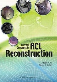Enlarge image Cover: Current Concepts in ACL Reconstruction - SLACK Incorporated