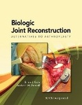Cover: Biologic Joint Reconstruction - SLACK  Incorporated