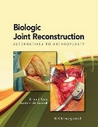 Enlarge image Cover: Biologic Joint Reconstruction - SLACK Incorporated