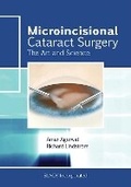 Cover: Microincisional Cataract Surgery - SLACK  Incorporated