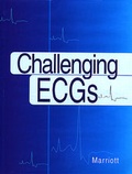 Cover: Challenging ECGs - Hanley & Belfus Inc.