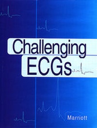 Enlarge image Cover: Challenging ECGs - Hanley & Belfus Inc.