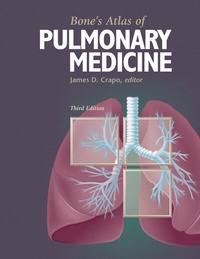 Abbildung von: Bone's Atlas of Pulmonary Medicine - Current Medicine,U.S.