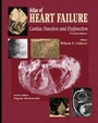 Cover: Atlas of HEART FAILURE - Current Medicine,U.S.