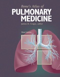 Abbildung von: Bone's Atlas of Pulmonary Medicine - Current Medicine,U.S.