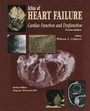 Cover: Atlas of HEART FAILURE - Current Medicine