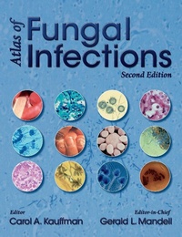 Enlarge image Cover: Atlas of Fungal Infections - Current Medicine Group