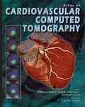 Cover: Atlas of Cardiovascular Computed Tomography - Current Medicine Group