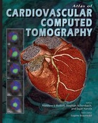 Enlarge image Cover: Atlas of Cardiovascular Computed Tomography - Current Medicine Group