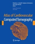 Cover: Atlas of Cardiovascular Computed Tomography - Current Medicine,U.S.
