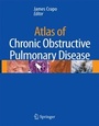 Cover: Atlas of Chronic Obstructive Pulmonary Disease - Current Medicine,U.S.