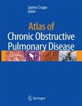 Cover: Atlas of Chronic Obstructive Pulmonary Disease - Current Medicine,U.S.