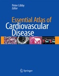 Abbildung von: Essential Atlas of Cardiovascular Disease - Current Medicine,U.S.