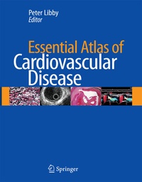 Abbildung von: Essential Atlas of Cardiovascular Disease - Current Medicine,U.S.