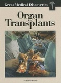 Cover: Organ Transplants - Lucent Books