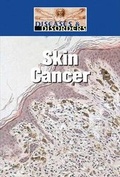 Cover: Skin Cancer - Lucent Books
