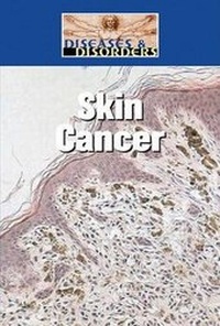 Enlarge image Cover: Skin Cancer - Lucent Books