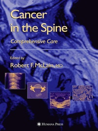 Enlarge image Cover: Cancer in the Spine - Humana Press Inc.