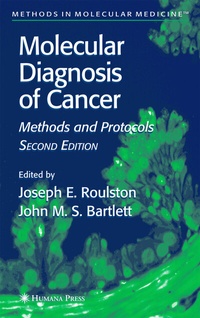 Abbildung von: Molecular Diagnosis of Cancer - Humana Press Inc.