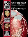 Cover: CT of the Heart - Humana Press Inc.