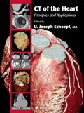 Cover: CT of the Heart - Humana