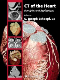 Enlarge image Cover: CT of the Heart - Humana