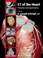 Cover: CT of the Heart - Humana Press Inc.