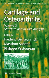 Abbildung von: Cartilage and Osteoarthritis - Humana Press Inc.