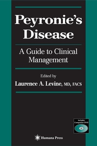 Abbildung von: Peyronie's Disease - Humana Press Inc.
