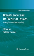 Cover: Breast Cancer and its Precursor Lesions - Humana