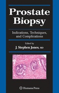 Cover: Prostate Biopsy - Humana