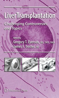 Abbildung von: Liver Transplantation - Humana Press