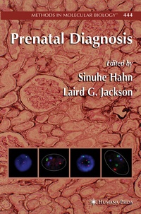 Abbildung von: Prenatal Diagnosis - Humana