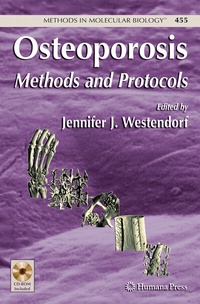 Abbildung von: Osteoporosis - Humana Press Inc.