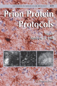 Abbildung von: Prion Protein Protocols - Humana Press Inc.