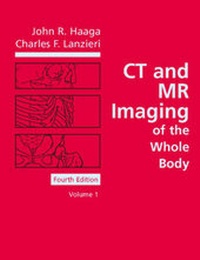 Abbildung von: CT and MR Imaging of the Whole Body - Mosby