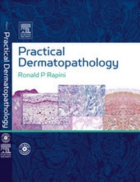 Enlarge image Cover: Practical Dermatopathology - Mosby