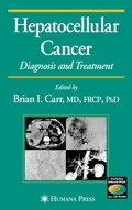 Cover: Hepatocellular Carcinoma - Humana